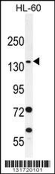SPECC1 Antibody (Center)