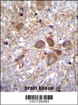 SPECC1 Antibody (Center)