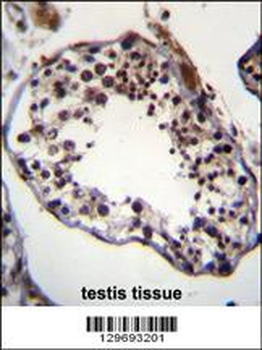 TRIM69 Antibody (N-term)