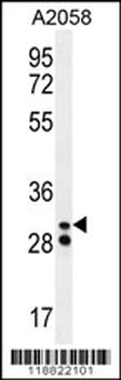 Neutrophil elastase Antibody (N-term)