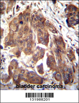 GLMN Antibody (C-term)