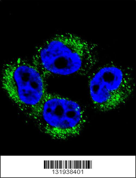 AP1M1 Antibody (Center)
