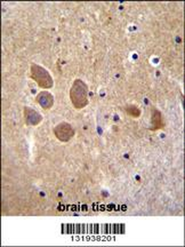 AP1M1 Antibody (Center)