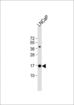 TBCA Antibody (Center)