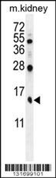 TBCA Antibody (Center)