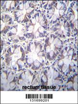 TBCA Antibody (Center)