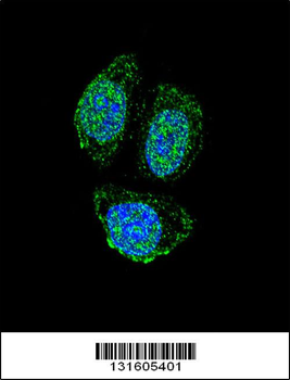 IL17B Antibody (Center)