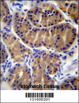 IL17B Antibody (Center)