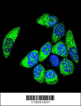 WT1 Antibody (Center E361)