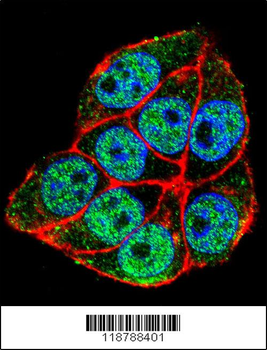 TRADD Antibody (Center)