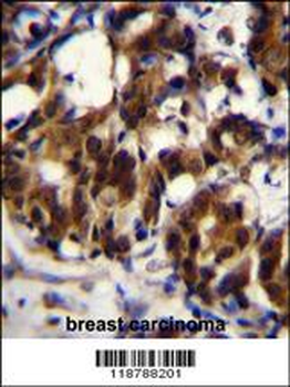 TRADD Antibody (Center)