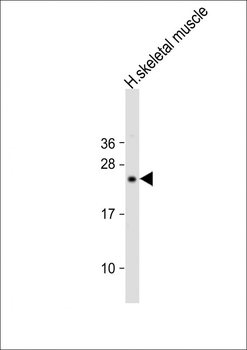 DDIT3 Antibody (C-term A135)