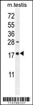 DDIT3 Antibody (C-term A135)