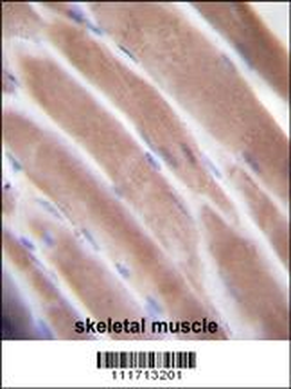 VEGF3 Antibody (N-term)
