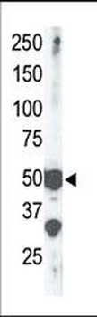 SET7 (SET9) Antibody (Center)