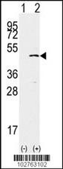SET7 (SET9) Antibody (Center)