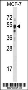 SET7 (SET9) Antibody (Center)