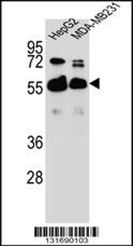RAP1GDS1 Antibody (Center)