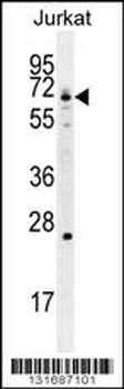 GCLC Antibody (N-term)