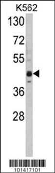 SET07 Antibody (C-term)