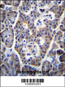 TP53INP1 Antibody (C-term)