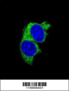 MMP1 Antibody (Center)