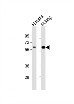 TGFBR2 Antibody (N-term)