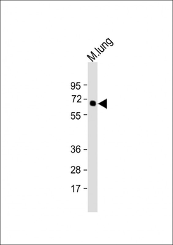 TGFBR2 Antibody (N-term)