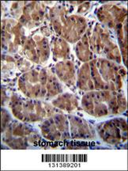 SOCS4 Antibody (Center)