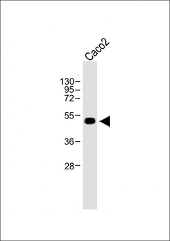 WTIP Antibody (C-term)