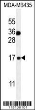 S100A1 Antibody (C-term)