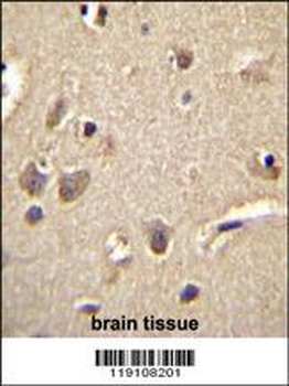 S100A1 Antibody (C-term)