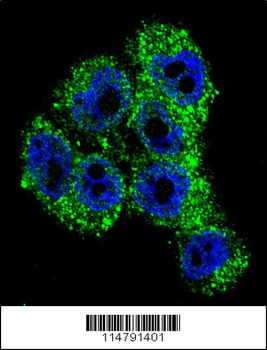 TRPM8 Antibody (Center)