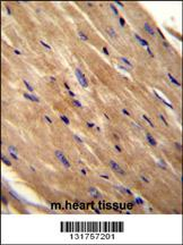 RHOJ Antibody (Center)
