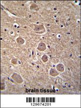 TP53INP1 Antibody (N-term)