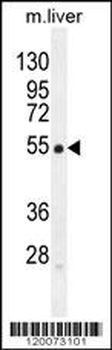 GLUD1 Antibody (C-term)