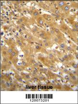 GLUD1 Antibody (C-term)