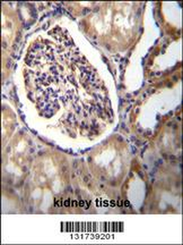 AKR1C3 Antibody (Center)