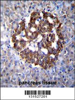 PCDH20 Antibody (Center)