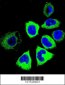TUBB8B Antibody (C-term)