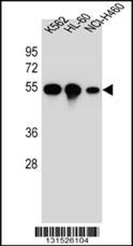 TUBB8B Antibody (C-term)