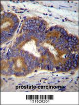 TUBB8B Antibody (C-term)