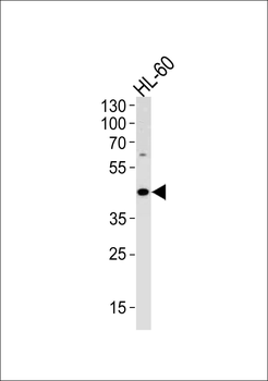 ADA Antibody (C-term)