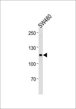 MSH2 Antibody (Center)