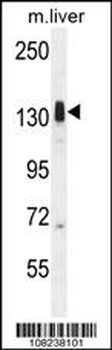 LMTK3 Antibody (N-term)