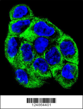 ATP6V1B1 Antibody (Center)