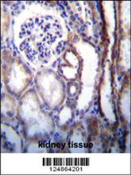 ATP6V1B1 Antibody (Center)