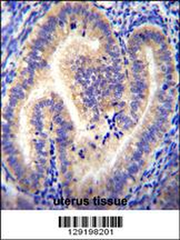 CCDC54 Antibody (Center)