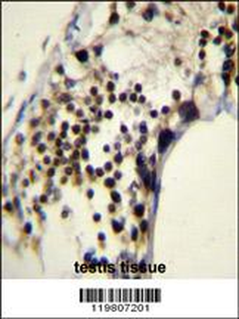 RACGAP1 Antibody (N-term)