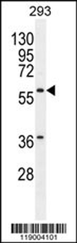 CPA2 Antibody (Center)